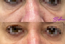 Medic Bun Gheorgheni Dr. Adelina Pop - Chirurgie Plastica, Estetica si Microchirurgie Reconstructiva