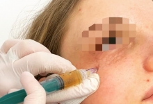 Medic Bun Gheorgheni Dr. Adelina Pop - Chirurgie Plastica, Estetica si Microchirurgie Reconstructiva