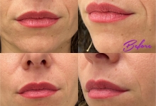 Medic Bun Reghin Dr. Adelina Pop - Chirurgie Plastica, Estetica si Microchirurgie Reconstructiva
