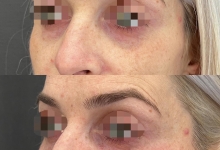 Medic Bun Reghin Dr. Adelina Pop - Chirurgie Plastica, Estetica si Microchirurgie Reconstructiva