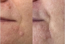Medic Bun Reghin Dr. Adelina Pop - Chirurgie Plastica, Estetica si Microchirurgie Reconstructiva