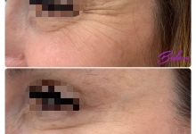 Medic Bun Reghin Dr. Adelina Pop - Chirurgie Plastica, Estetica si Microchirurgie Reconstructiva
