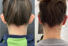 Medic Bun Sibiu Dr. Adelina Pop - Chirurgie Plastica, Estetica si Microchirurgie Reconstructiva