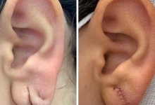 Medic Bun Sibiu Dr. Adelina Pop - Chirurgie Plastica, Estetica si Microchirurgie Reconstructiva