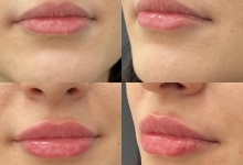 Medic Bun Sighisoara Dr. Adelina Pop - Chirurgie Plastica, Estetica si Microchirurgie Reconstructiva