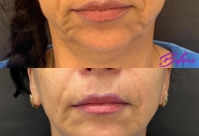 Medic Bun Sighisoara Dr. Adelina Pop - Chirurgie Plastica, Estetica si Microchirurgie Reconstructiva