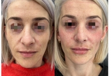Medic Bun Tarnaveni Dr. Adelina Pop - Chirurgie Plastica, Estetica si Microchirurgie Reconstructiva
