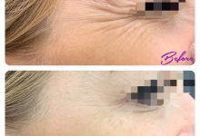 Medic Bun Toplita Dr. Adelina Pop - Chirurgie Plastica, Estetica si Microchirurgie Reconstructiva