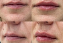 Medic Bun Toplita Dr. Adelina Pop - Chirurgie Plastica, Estetica si Microchirurgie Reconstructiva
