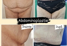 Medic Bun Pitesti Dr. Iordache Madalina