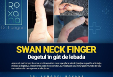 Medic Bun Braila Dr. Lungoci Roxana - Chirurgie Plastica, Estetica si Chirurgia Mainii