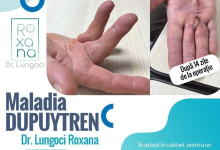 Medic Bun Calarasi Dr. Lungoci Roxana - Chirurgie Plastica, Estetica si Chirurgia Mainii