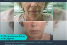 Medic Bun Constanta Dr. Lungoci Roxana - Chirurgie Plastica, Estetica si Chirurgia Mainii
