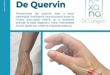 Medic Bun Constanta Dr. Lungoci Roxana - Chirurgie Plastica, Estetica si Chirurgia Mainii