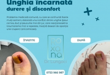 Medic Bun Constanta Dr. Lungoci Roxana - Chirurgie Plastica, Estetica si Chirurgia Mainii
