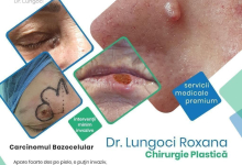 Medic Bun Eforie Sud Dr. Lungoci Roxana - Chirurgie Plastica, Estetica si Chirurgia Mainii