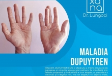 Medic Bun Harsova Dr. Lungoci Roxana - Chirurgie Plastica, Estetica si Chirurgia Mainii