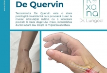 Medic Bun Harsova Dr. Lungoci Roxana - Chirurgie Plastica, Estetica si Chirurgia Mainii