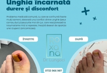 Medic Bun Harsova Dr. Lungoci Roxana - Chirurgie Plastica, Estetica si Chirurgia Mainii