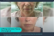 Medic Bun Harsova Dr. Lungoci Roxana - Chirurgie Plastica, Estetica si Chirurgia Mainii