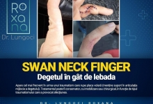 Medic Bun Harsova Dr. Lungoci Roxana - Chirurgie Plastica, Estetica si Chirurgia Mainii