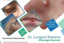 Medic Bun Harsova Dr. Lungoci Roxana - Chirurgie Plastica, Estetica si Chirurgia Mainii