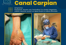 Medic Bun Isaccea Dr. Lungoci Roxana - Chirurgie Plastica, Estetica si Chirurgia Mainii