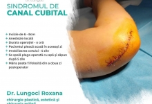 Medic Bun Lumina Dr. Lungoci Roxana - Chirurgie Plastica, Estetica si Chirurgia Mainii