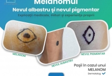 Medic Bun Lumina Dr. Lungoci Roxana - Chirurgie Plastica, Estetica si Chirurgia Mainii