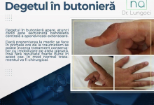 Medic Bun Negru Voda Dr. Lungoci Roxana - Chirurgie Plastica, Estetica si Chirurgia Mainii