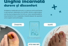 Medic Bun Ovidiu Dr. Lungoci Roxana - Chirurgie Plastica, Estetica si Chirurgia Mainii