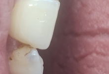 Medic Bun Campulung Muscel Endodontie Campulung Muscel - Clinica Dr. Gupta