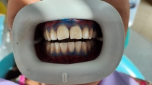 Medic Bun Campulung Muscel Endodontie Campulung Muscel - Clinica Dr. Gupta