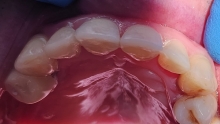 Medic Bun Campulung Muscel Endodontie Campulung Muscel - Clinica Dr. Gupta