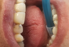 Medic Bun Campulung Muscel Endodontie Campulung Muscel - Clinica Dr. Gupta