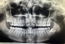 Medic Bun Campulung Muscel Endodontie Campulung Muscel - Clinica Dr. Gupta