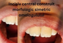 Medic Bun Campulung Muscel Endodontie Campulung Muscel - Clinica Dr. Gupta
