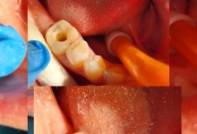 Medic Bun Campulung Muscel Endodontie Campulung Muscel - Clinica Dr. Gupta