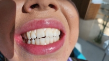 Medic Bun Campulung Muscel Endodontie Campulung Muscel - Clinica Dr. Gupta