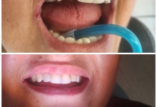 Medic Bun Curtea de Arges Endodontie Curtea de Arges - Clinica Dr. Gupta