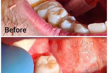 Medic Bun Curtea de Arges Endodontie Curtea de Arges - Clinica Dr. Gupta