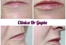 Medic Bun Campulung Muscel Estetica Infrumusetare Campulung Muscel - Clinica Dr. Gupta
