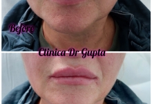 Medic Bun Campulung Muscel Estetica Infrumusetare Campulung Muscel - Clinica Dr. Gupta