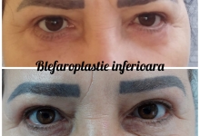 Medic Bun Campulung Muscel Estetica Infrumusetare Campulung Muscel - Clinica Dr. Gupta