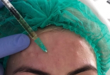 Medic Bun Mioveni Estetica Infrumusetare Mioveni - Clinica Dr. Gupta