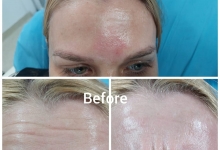 Medic Bun Pitesti Estetica Infrumusetare Pitesti - Clinica Dr. Gupta