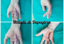 Medic Bun Campulung Muscel Laborator Analize Campulung Muscel - Clinica Dr. Gupta