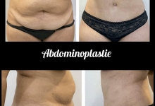Medic Bun Campulung Muscel Laborator Analize Campulung Muscel - Clinica Dr. Gupta