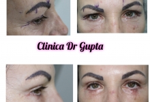 Medic Bun Campulung Muscel Laborator Analize Campulung Muscel - Clinica Dr. Gupta