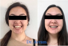 Medic Bun Bistrita Ortodontie si Implantologie Dentara Bistrita - Avram Orthodontic Clinic
